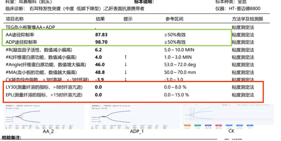 889f0dfa-acd5-45b3-9cb5-ff84283d6c88.png 889f0dfa-acd5-45b3-9cb5-ff84283d6c88.png